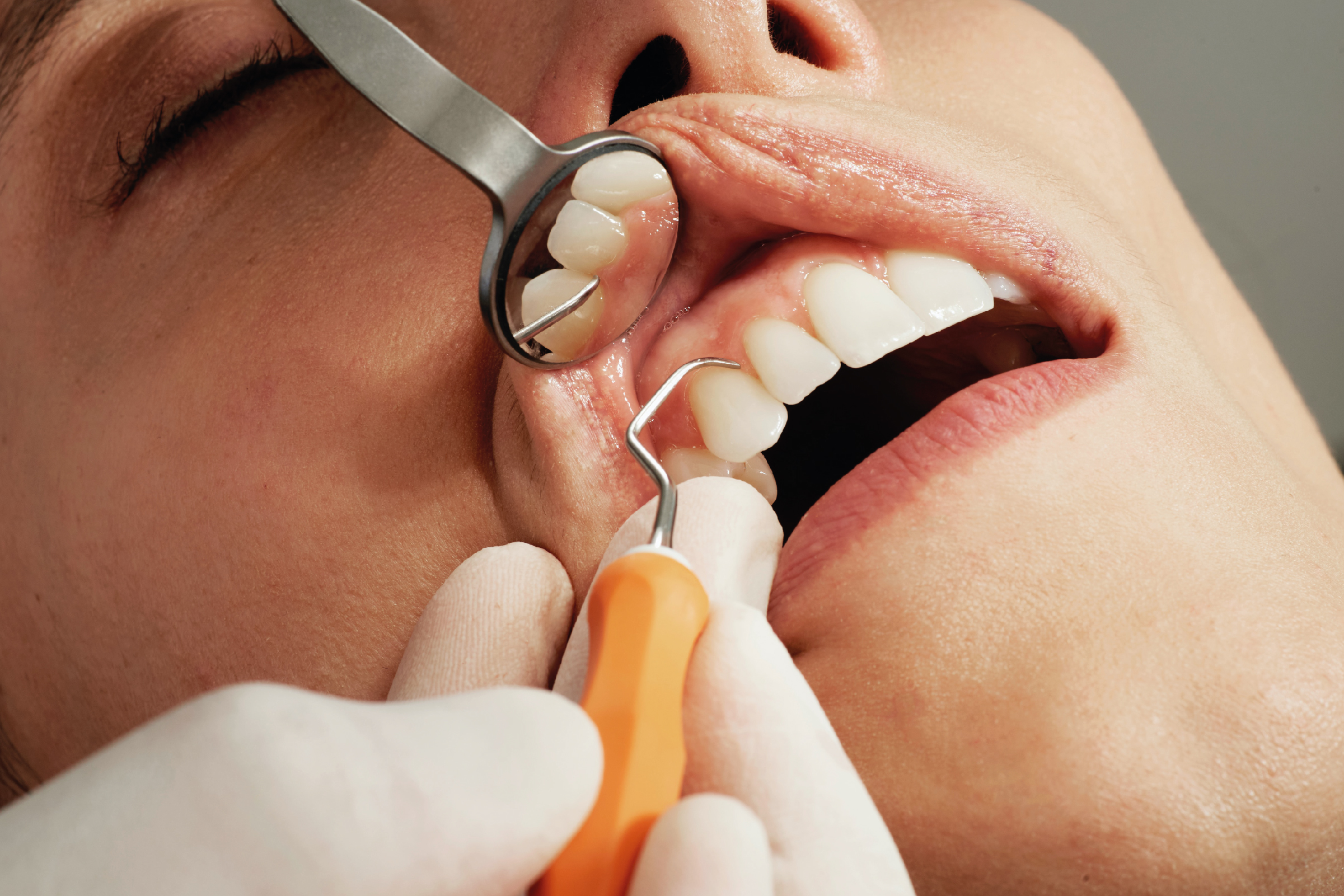 señales de que necesitas revisión dental urgente