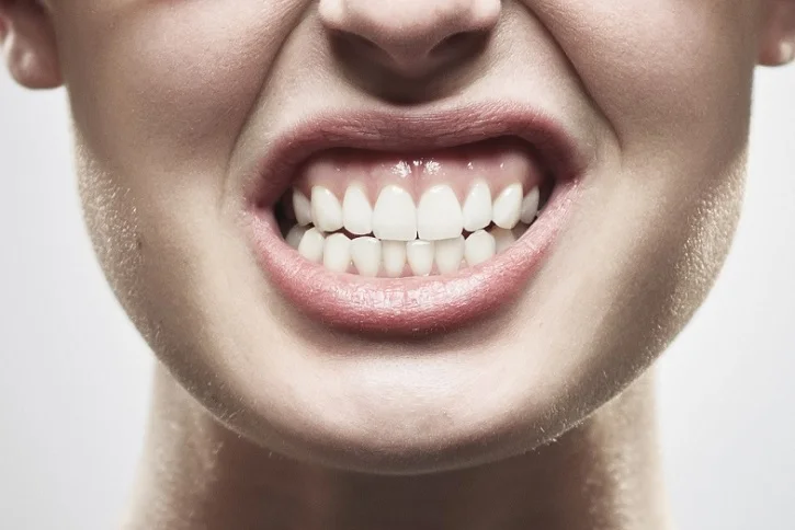 Cómo afecta el bruxismo a tus dientes y qué soluciones existen